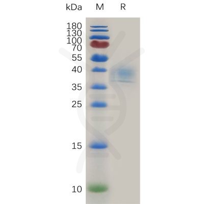 sp-pme100776 cd52 sp1