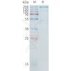 sp-pme100808 itgam sp1