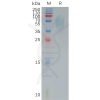 sp-pme100827 cd200r1 sp1