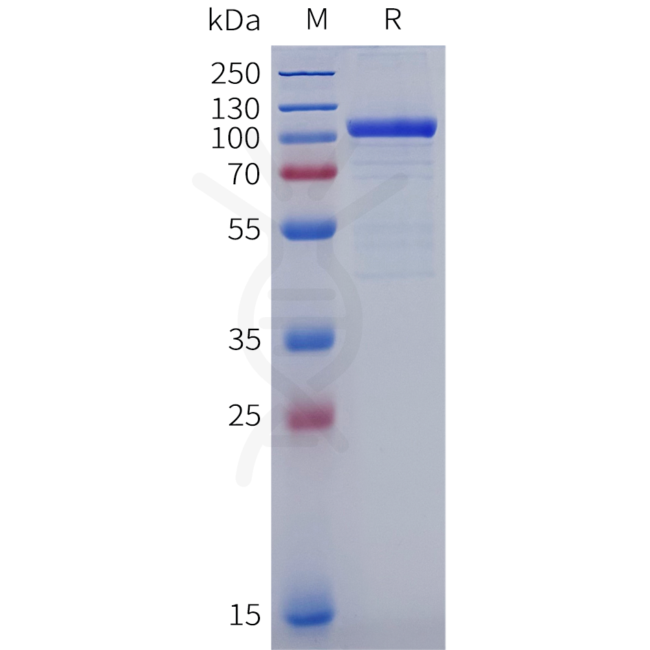 pme100847-lgals3bp-sp1.png