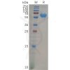 sp-pme100855 vsig4 sp1
