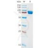 sp-pme100886 il1ra sp1