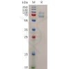 sp-pme100895 magea4 sp1