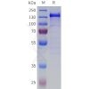 sp-pme100913 bai1 sp1
