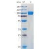 sp-pme100930 gm csfr sp1