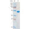 sp-pme100952 lgals1 sp1