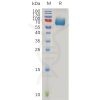 sp-pme100959 ifnar2 sp1