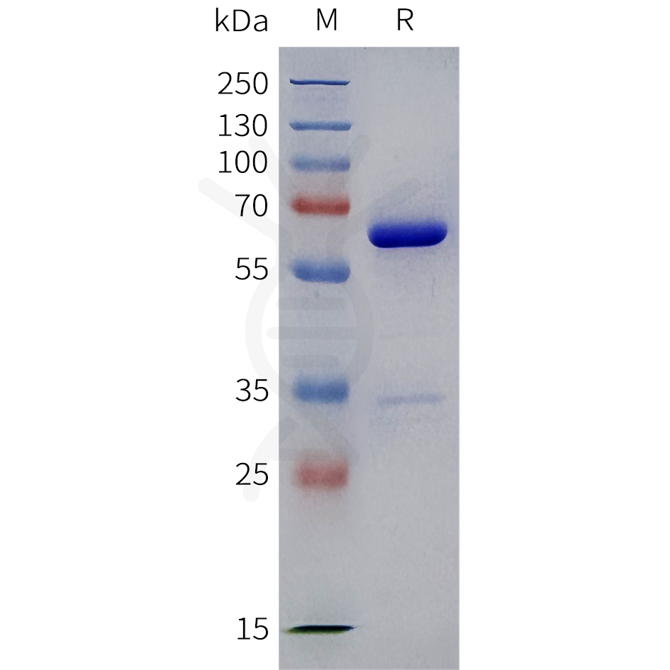 sp-pme100963 igfbp2 sp1