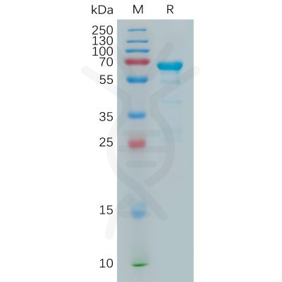 sp-pme100981 mmp2 sp1