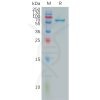sp-pme101051 fgl1 sp1