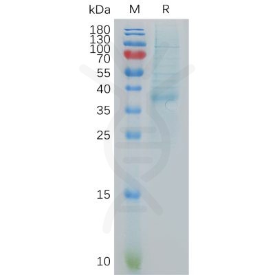 sp-pme101060 cxcl13 sp1