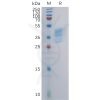 sp-pme101112 ccr4 sp1