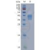 sp-pme101118 f2rl1 sp1