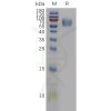 sp-pme101126 il18bp sp1