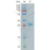 sp-pme101142 btn3a2 sp1