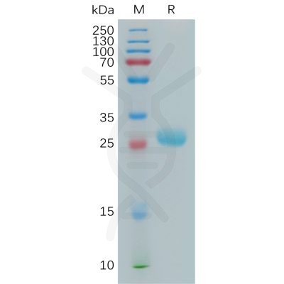 sp-pme101142 btn3a2 sp1