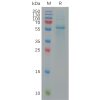 sp-pme101146 s protein rbd sp1