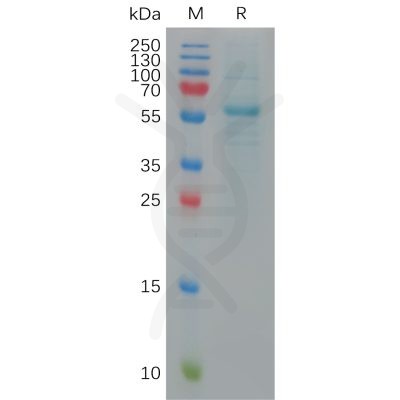 sp-pme101146 s protein rbd sp1