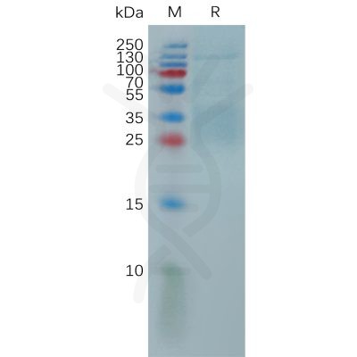 sp-pme101155 il9 sp1