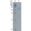 sp-pme101161 e8l sp1