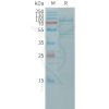 sp-pme101171 cdh11 sp1