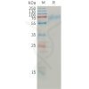 sp-pme101211 angpt2 sp1