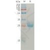 sp-pme101212 angpt2 sp1