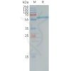 sp-pme101242 alpp sp1