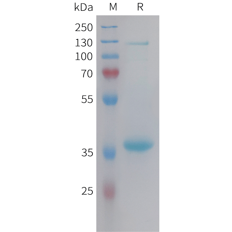 pme101455-npy-sp1.jpg