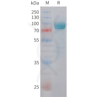 sp-pme101480 dkk3 sp1