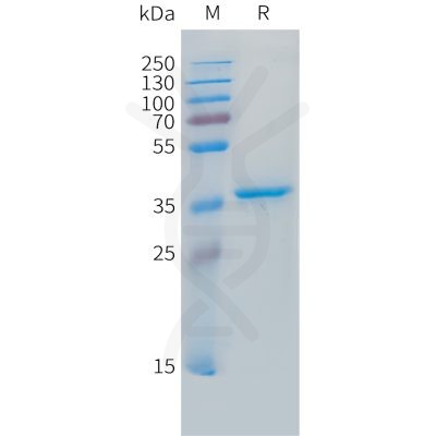 sp-pme101488 igf2 sp1