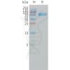 sp-pme101502 il1ra sp1