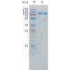 sp-pme101507 il1r2 sp1