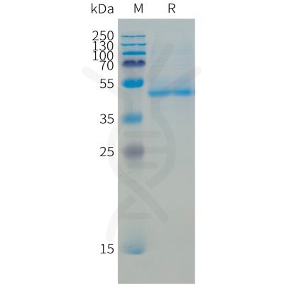 sp-pme101509 b4galt1 sp1