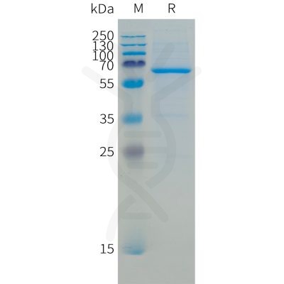 sp-pme101511 cd73 sp1