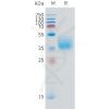 sp-pme101516 ifngr1 sp1