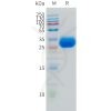 sp-pme101517 lamp5 sp1