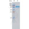 sp-pme101520 pth1r sp1