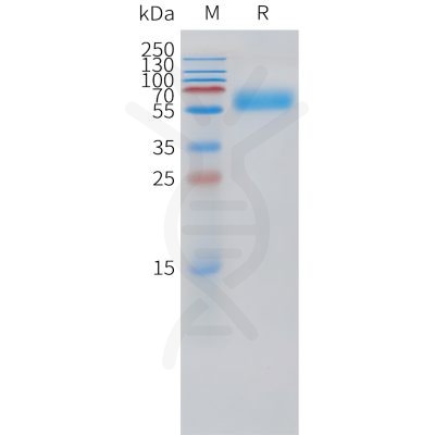sp-pme101520 pth1r sp1