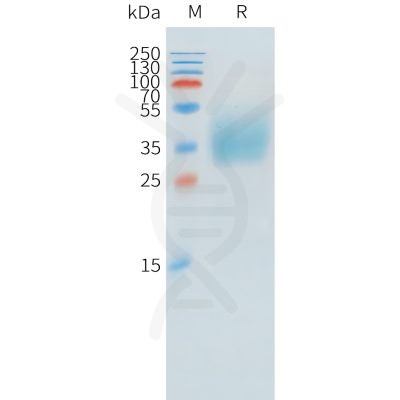 sp-pme101541 kir2dl1 sp1