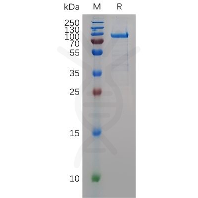 sp-pme101543 mmp9 sp1