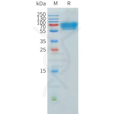 sp-pme101551 acvr2b sp1