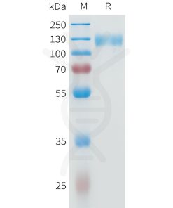 sp-pme101597 il31ra sp1