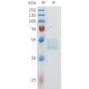 sp-pme101603 cd117 sp1