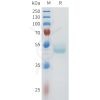 sp-pme101607 cdh1 sp1
