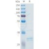 sp-pme101612 fgf2 sp1