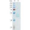 sp-pme101613 cdh3 sp1