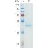sp-pme101614 cdh3 sp1