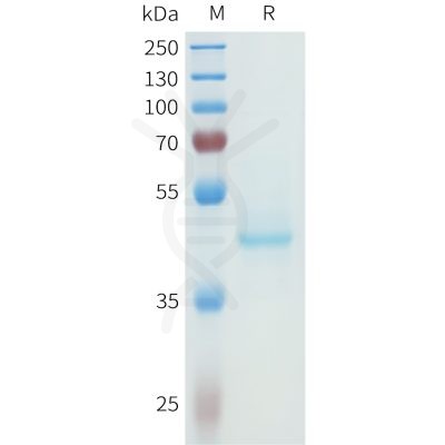 sp-pme101614 cdh3 sp1