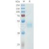 sp-pme101615 cdh3 sp1